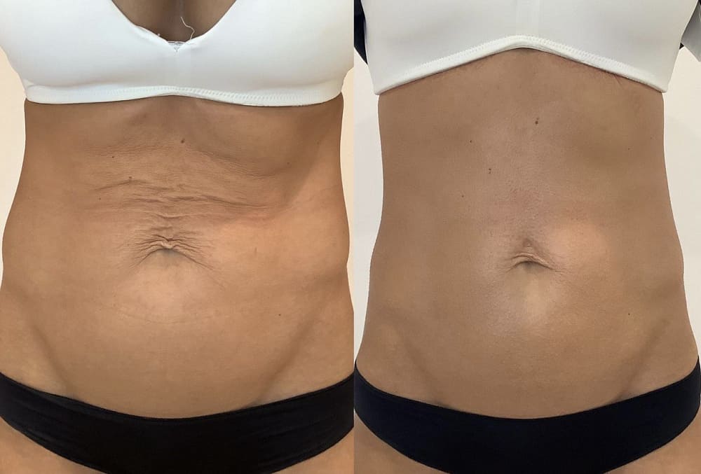 fyqc7bpqzdlpb0j5r03vjniggoi66r5p-1